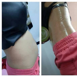 Kem tan mỡ quấn nilong thần thánh