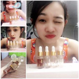 Serum kiều