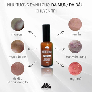 Nhũ tương trị mụn narguerite