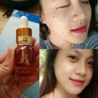 Sỉ serum kiều sll 500 1000 lọ giá 3x