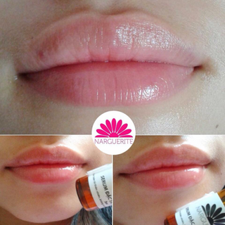 Serum đặc trị thâm môi