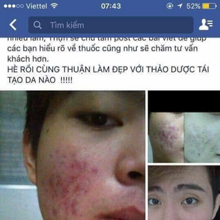 Thuốc mụn tái tạo da