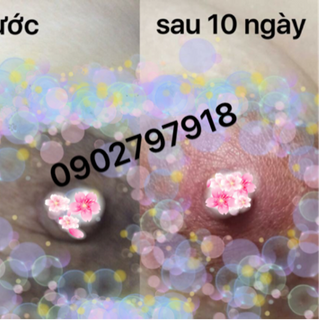 Beauty zone làm hồng nhũ hoa love kimberly