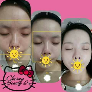 Kem baby girl-cherry beauty ds