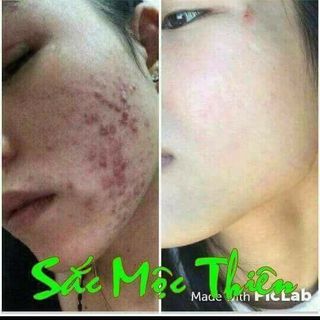 Sắc mộc thiên