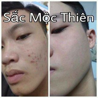 Sắc mộc thiên