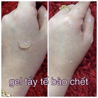 Gel tẩy tế bào chết spa hàn quốc