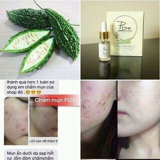 Chấm mụn pizu