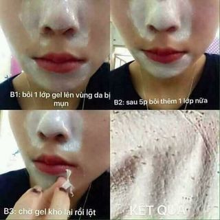Lột mụn trà xanh