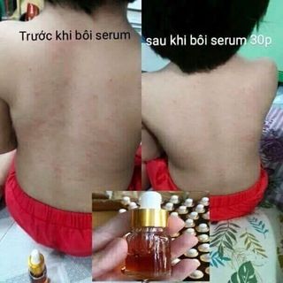 Serum thảo dược kiều