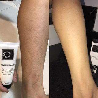Triệt lông cao câp CC White