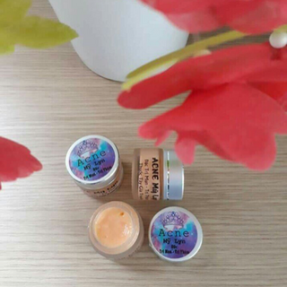 Kem đặc trị mụn gia truyền - tư vấn nhanh qua
