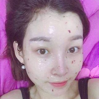 MASK ƯỚP CÁNH HOA HỒNG