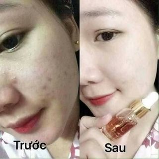 Serum thảo dược Kiều Beauty Queen