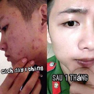 Serum Thảo Dược Hoàng Cung Kiều Beauty Queen