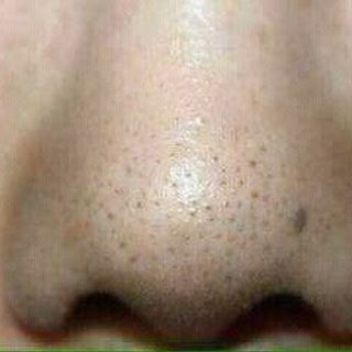 PURE SKIN của Oriflame