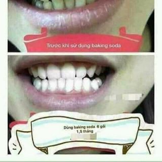 baking soda