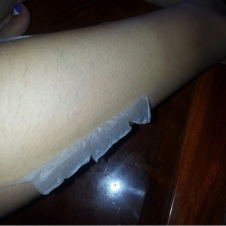 Lột Thay Da