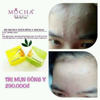 KEM ĐẶC TRỊ MỤN VÀ THÂM MOCHA