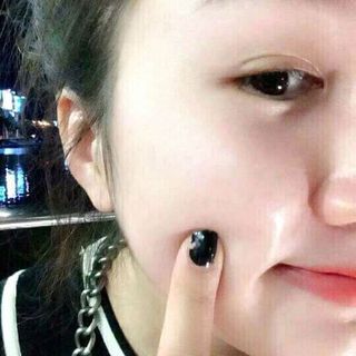 kem trị mun shelink