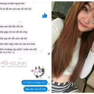 kem trị mun shelink