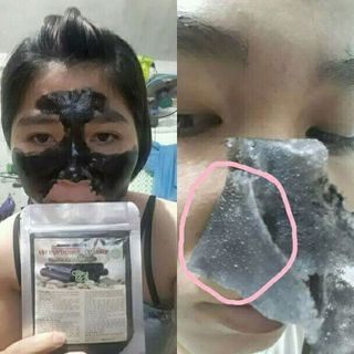 lột mụn than tre mỡ trăn dưỡng da