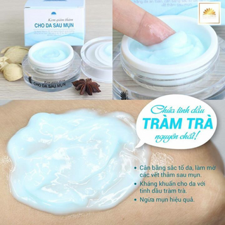 kem giảm thâm cho da sau mụn