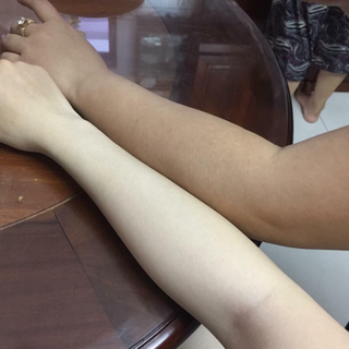 nước lột da sinh học