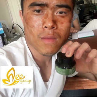 Cao neem