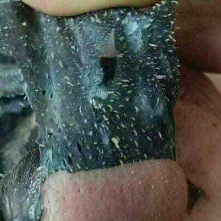 Gel hút mụn than tre hoạt tính