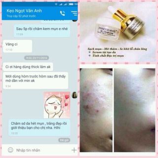 Kem đặc trị mụn SPL
