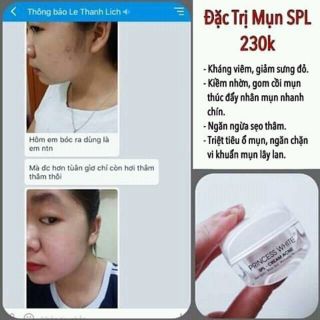 Kem đặc trị mụn SPL