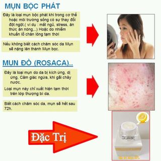 Kem đặc trị mụn SPL
