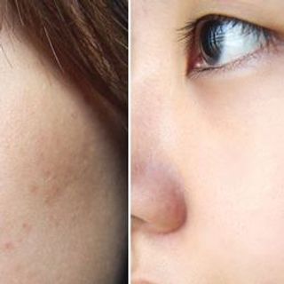 VACCI-KEM DƯỠNG TRANG ĐIỂM TRẮNG DA MẶT - CREAM