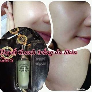 Huyết Thanh Skin Care