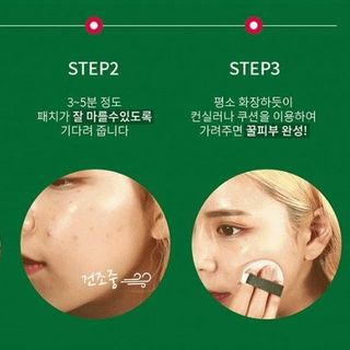 Gel vá da che mụn sẹo thần thánh Not4U Real Skin Patch