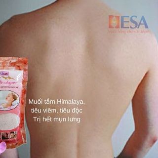 Sỉ Đá Muối Himalaya