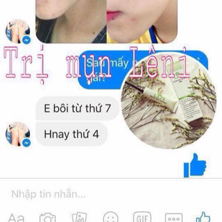 Leni thuốc đặc trị mụn