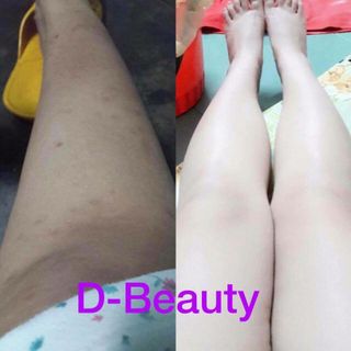 kem body D-BEAUTY
