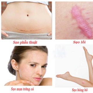 TRỊ SẸO NGA SỈ 58K
