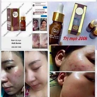 Kem Trị Mụn Độc Quyền My Miu