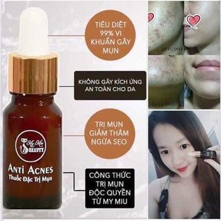 Kem Trị Mụn Độc Quyền My Miu