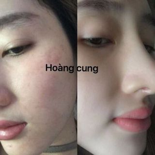 Bộ Kem Hoàng Cung 100
