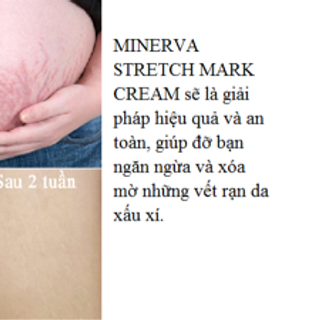 Kem trị rạn da nhăn da minerva stretch mark cread