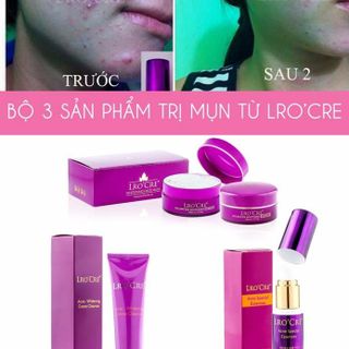 TRỊ MỤN LROCRE - SẠCH MỤN SÁNG DA CAM KẾT HIỆU QUẢ