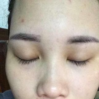 bột thuốc bắc trị mụn