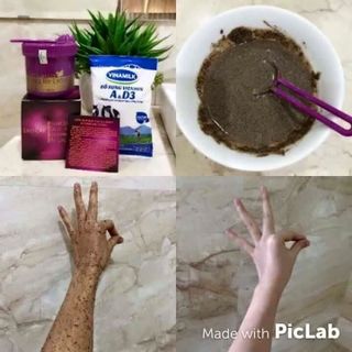 TẨY TẾ BÀO CHẾT - NHẢ NẮNG HIỆU QUẢ GIÚP DA SÁNG MỊN TRỊ VIÊM NANG LÔNG