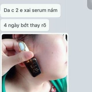 serum đặc trị nám tàn nhang đồi mồi