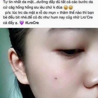 TRÀ XANH DỊU NHẸ - TRẮNG MỊN CĂNG BÓNG DÀNH CHO DA NHẠY CẢM DA KHÔ