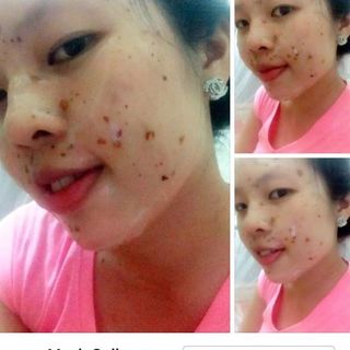 MẶT NẠ HOA TƯỜNG VY